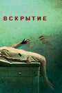 Фильм «Вскрытие» смотреть онлайн фильм в хорошем качестве 1080p