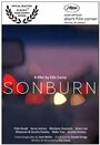 Sonburn