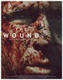 The Wound